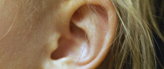 Рожистое воспаление уха