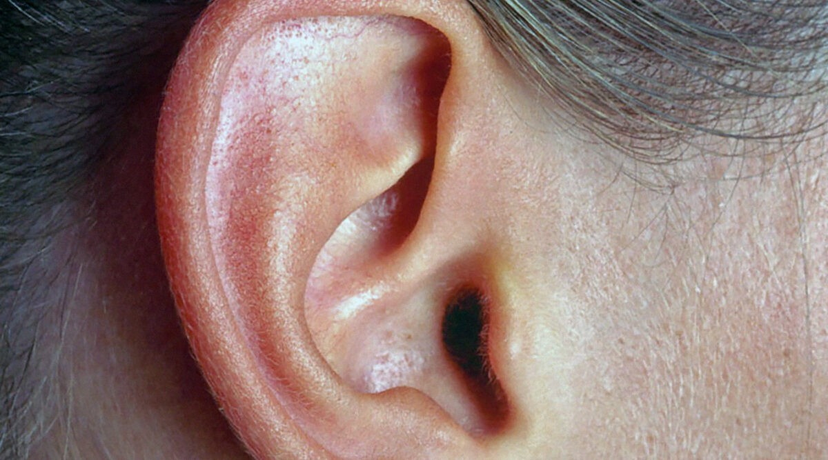 Повязка на ухо