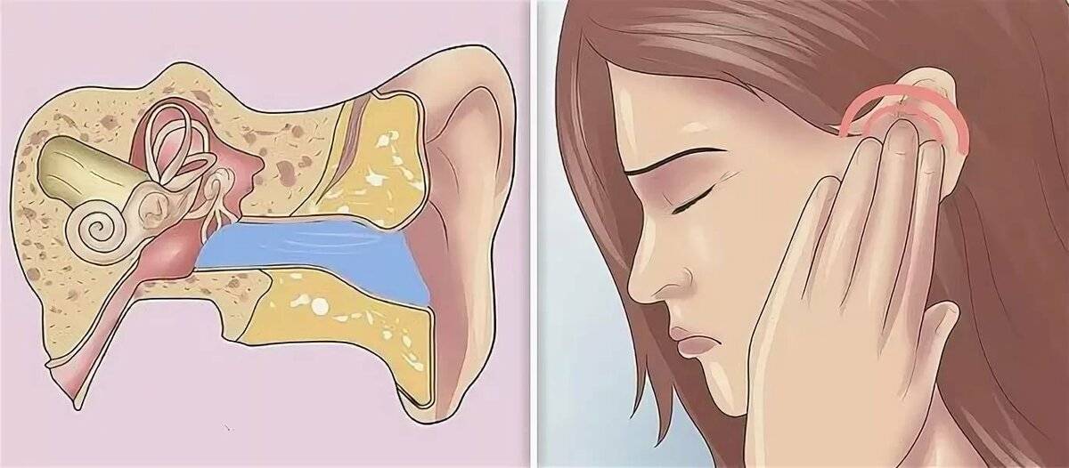 Почему течет из уха жидкость